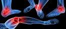 What Insoles Can Help With Your Foot Problems