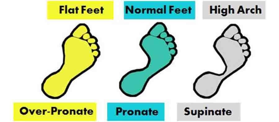 鞋垫推荐:足底筋膜炎