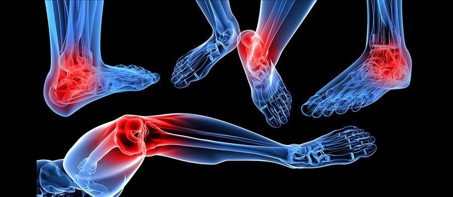 The Running Doctor: Prevenção e tratamento da artrite